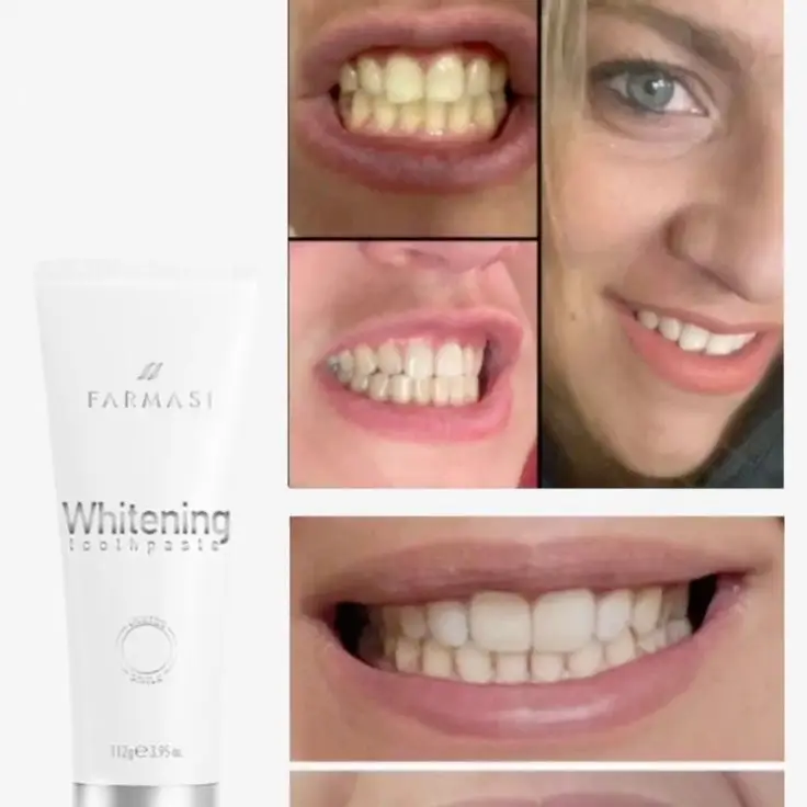 Pasta blanqueadora dental/venta en USD's photo #1